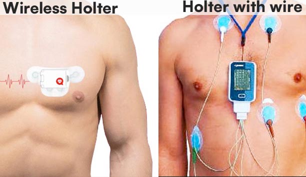 why-need-holter-monitor-test