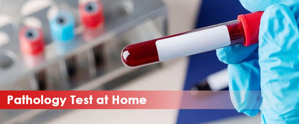 blood-test-in-delhi